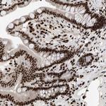 C17orf49 Antibody in Immunohistochemistry (Paraffin) (IHC (P))