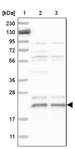 C17orf49 Antibody in Western Blot (WB)