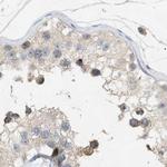 DCAF7 Antibody in Immunohistochemistry (IHC)