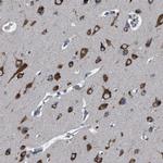 NMT1 Antibody in Immunohistochemistry (IHC)