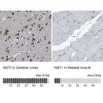 NMT1 Antibody