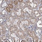 GRHPR Antibody in Immunohistochemistry (Paraffin) (IHC (P))