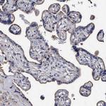 GRHPR Antibody in Immunohistochemistry (Paraffin) (IHC (P))