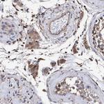 GRHPR Antibody in Immunohistochemistry (Paraffin) (IHC (P))