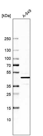 GRHPR Antibody in Western Blot (WB)