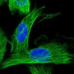 CCDC40 Polyclonal Antibody