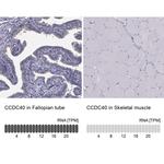 CCDC40 Antibody in Immunohistochemistry (IHC)