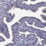 CCDC40 Antibody in Immunohistochemistry (IHC)