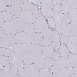 CCDC40 Antibody in Immunohistochemistry (IHC)