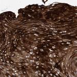 KRT24 Antibody in Immunohistochemistry (Paraffin) (IHC (P))