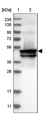 KRT24 Antibody in Western Blot (WB)