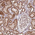 PCTP Antibody in Immunohistochemistry (Paraffin) (IHC (P))