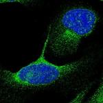 DHRS13 Polyclonal Antibody