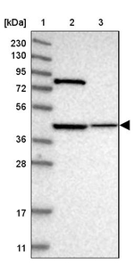 DHRS13 Antibody in Western Blot (WB)