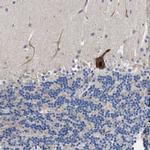 DHRS13 Antibody in Immunohistochemistry (IHC)