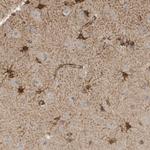 SLFN14 Polyclonal Antibody