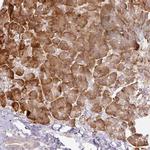 CCDC144A Polyclonal Antibody
