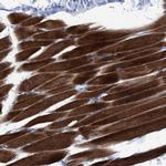 NBR1 Polyclonal Antibody