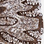 MRPS7 Polyclonal Antibody