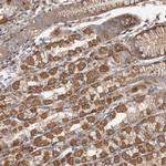 FAM221B Polyclonal Antibody