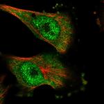 DNAJC7 Polyclonal Antibody