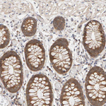 DNAJC7 Antibody in Immunohistochemistry (Paraffin) (IHC (P))