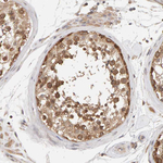 DNAJC7 Antibody in Immunohistochemistry (Paraffin) (IHC (P))