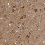 KLHL11 Antibody in Immunohistochemistry (Paraffin) (IHC (P))