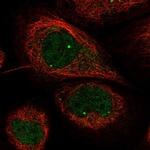 WRAP53 Polyclonal Antibody