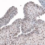 SLFN11 Antibody in Immunohistochemistry (IHC)
