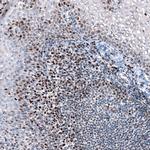 SLFN11 Antibody in Immunohistochemistry (IHC)