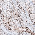 SLFN11 Antibody in Immunohistochemistry (IHC)