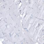 SLFN11 Antibody in Immunohistochemistry (IHC)