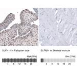 SLFN11 Antibody