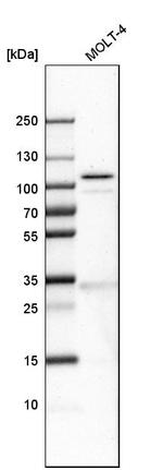 SLFN11 Antibody in Western Blot (WB)