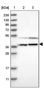 RNMTL1 Antibody in Western Blot (WB)