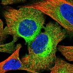 C17orf58 Polyclonal Antibody