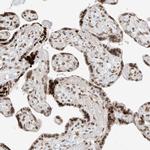 C17orf58 Antibody in Immunohistochemistry (Paraffin) (IHC (P))