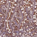 VMO1 Polyclonal Antibody