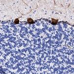 UBALD2 Polyclonal Antibody