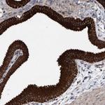 MRPL38 Antibody in Immunohistochemistry (IHC)