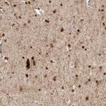 ZNF521 Antibody in Immunohistochemistry (IHC)