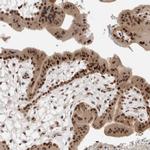 ZNF521 Antibody in Immunohistochemistry (IHC)