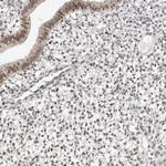 ZNF521 Antibody in Immunohistochemistry (IHC)