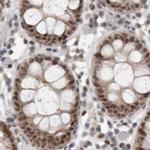 ZNF521 Antibody in Immunohistochemistry (IHC)