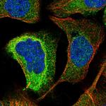 KIAA0753 Polyclonal Antibody