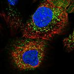 ADHFE1 Polyclonal Antibody