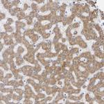 ADHFE1 Antibody in Immunohistochemistry (Paraffin) (IHC (P))