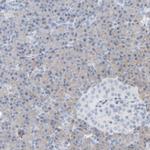 ADHFE1 Antibody in Immunohistochemistry (IHC)