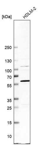 ADHFE1 Antibody in Western Blot (WB)